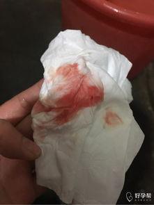 月经正常颜色的图片,自然生理现象的直观呈现